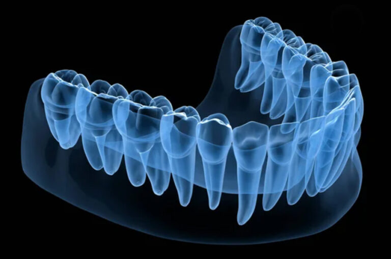 Dental-anatomy